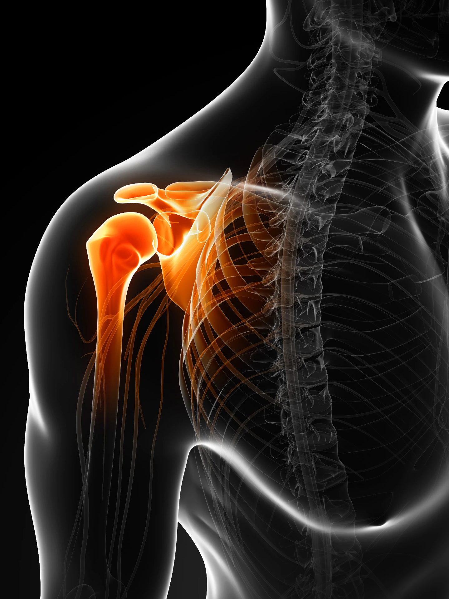 Lesión Lumbar: Del Gimnasio al Trabajo