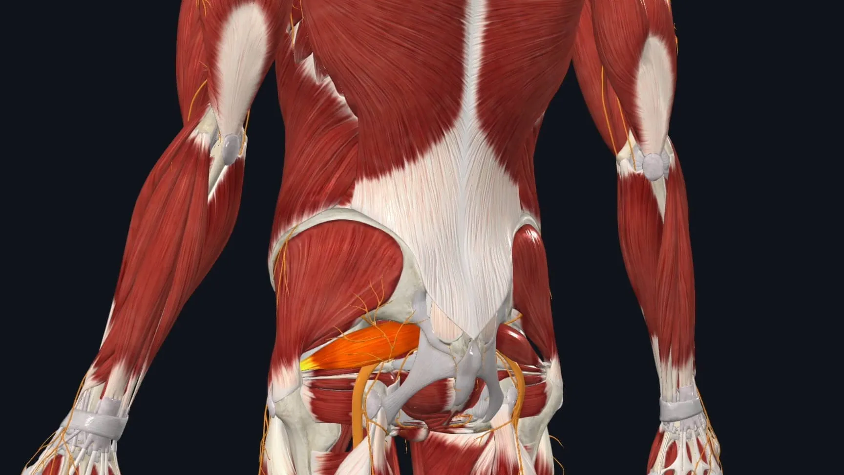 Síndrome del piramidal