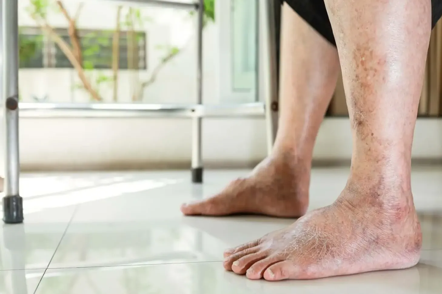 debilidad en las piernas