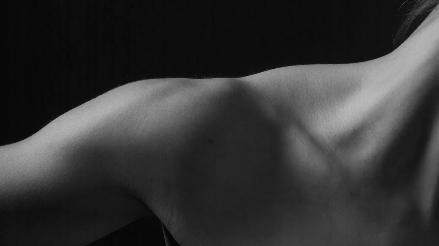 Disfunción de la Articulación Acromioclavicular