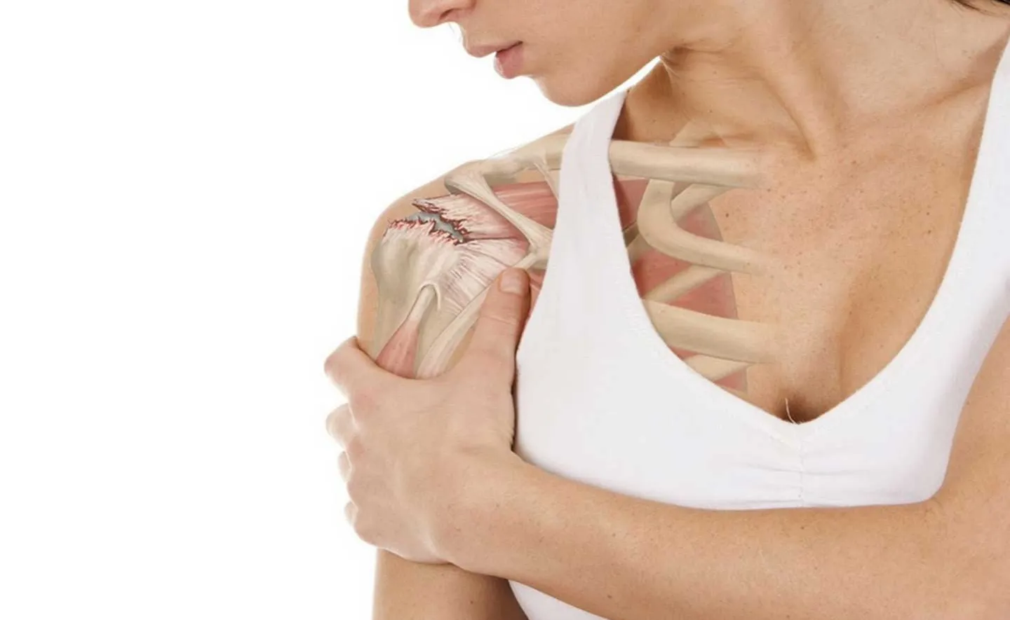 Dolor en el hombro y brazo