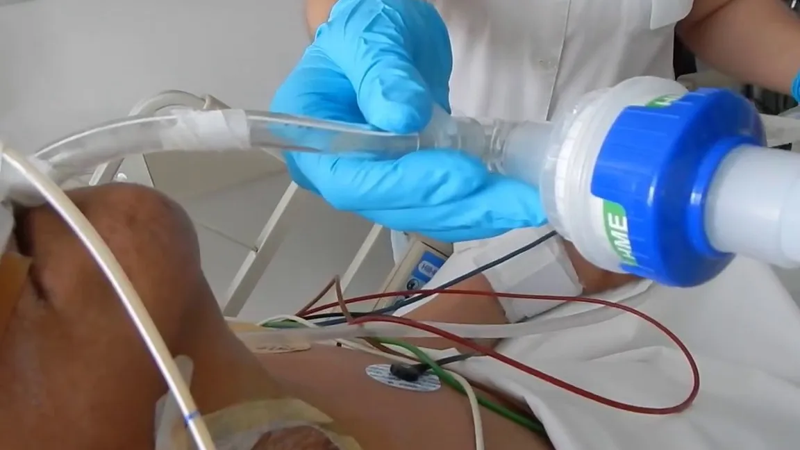 Drenaje de Secreciones