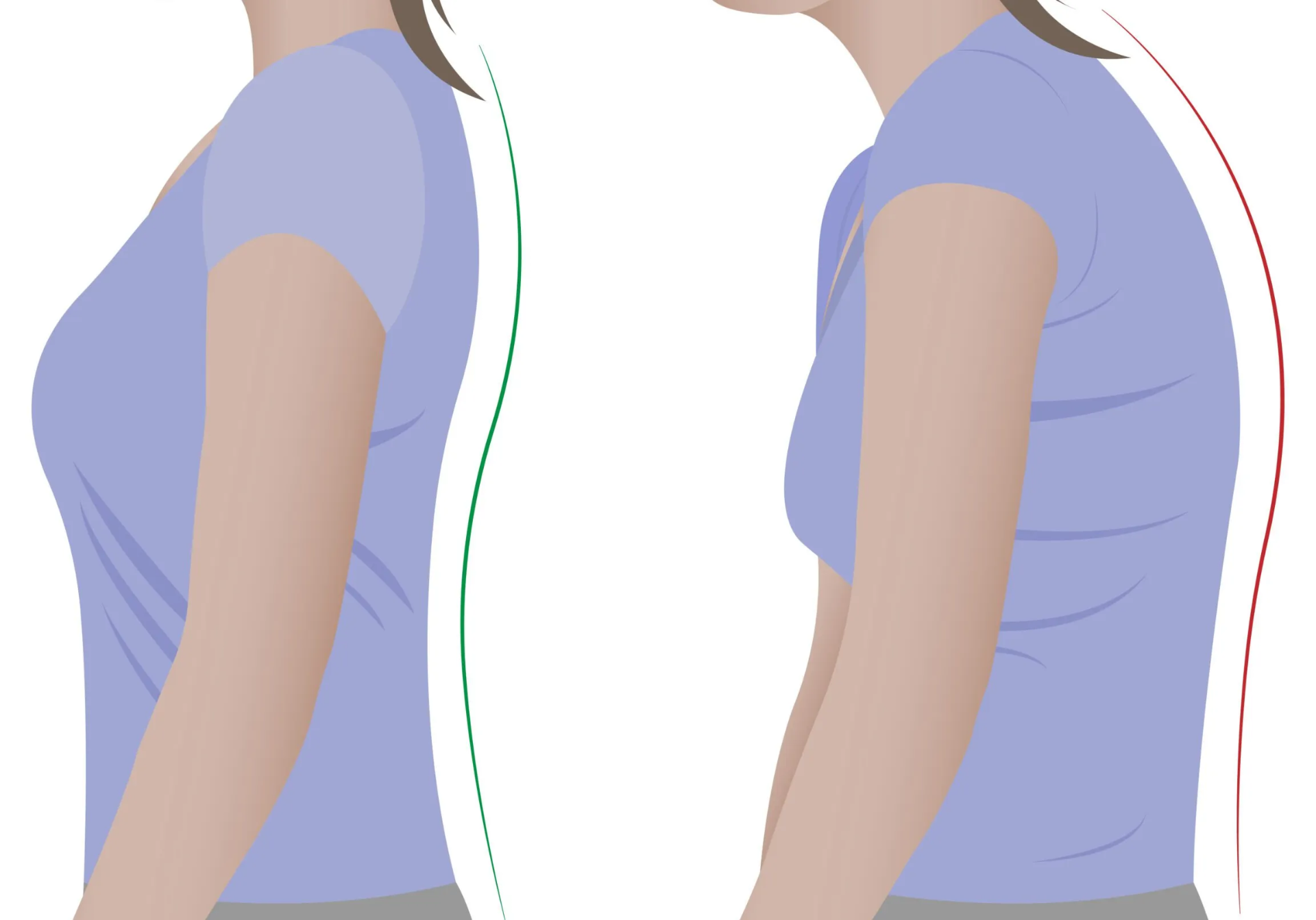 Problemas de postura